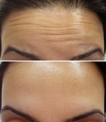 Lift, Tighten & Brighter - Celimax Retinal Glow boosting Cream